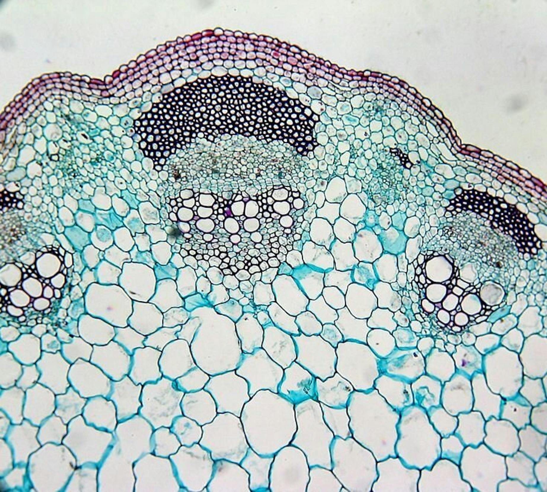 Микроскопические изменения в клетках